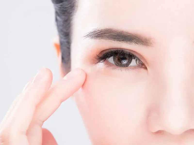 dermal fillers for tear troughs